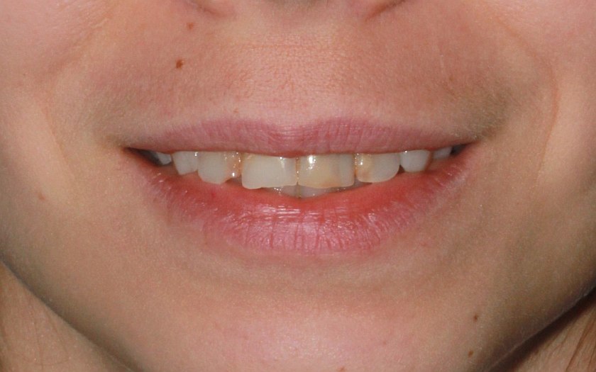 фото пациента, начальная ситуация