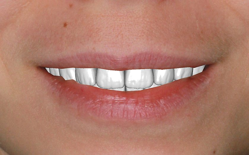 фото для сравнения, результат