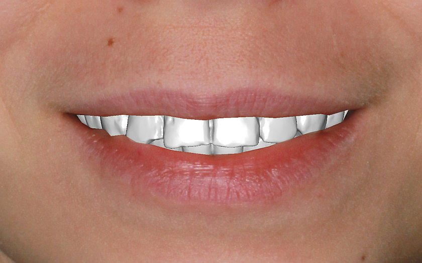 фото для сравнения, начало