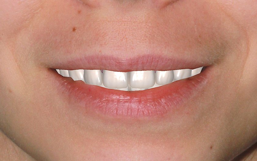 результат планирования, фотография и прогноз