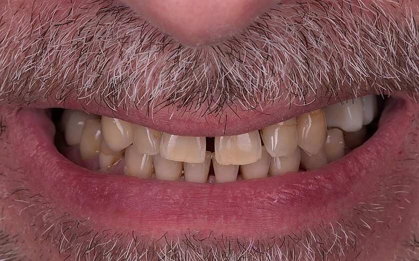 ситуация до планирования, фото