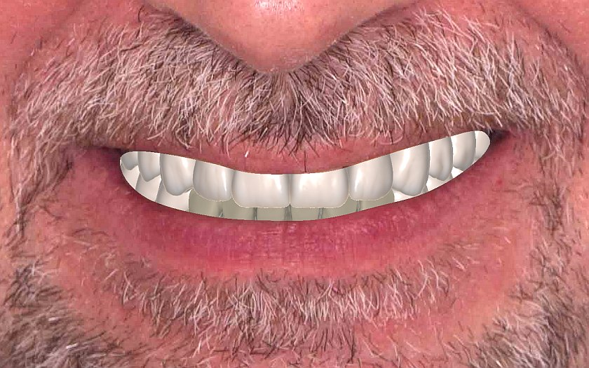 Сравнение до/после - результат